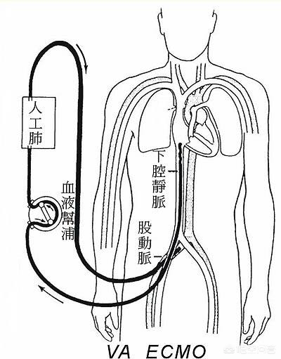 今日特码科普！流感后需警惕心肌炎,百科词条爱好