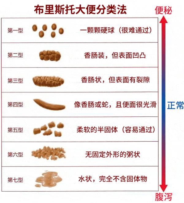 今日特码科普！腹泻几天确诊结肠癌,百科词条爱好