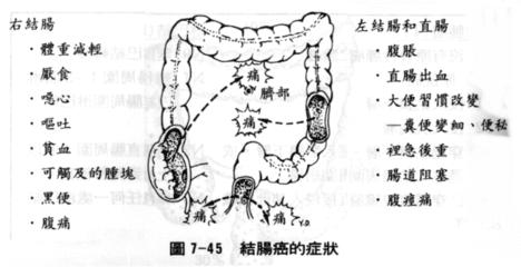 今日特码科普！腹泻几天确诊结肠癌,百科词条爱好